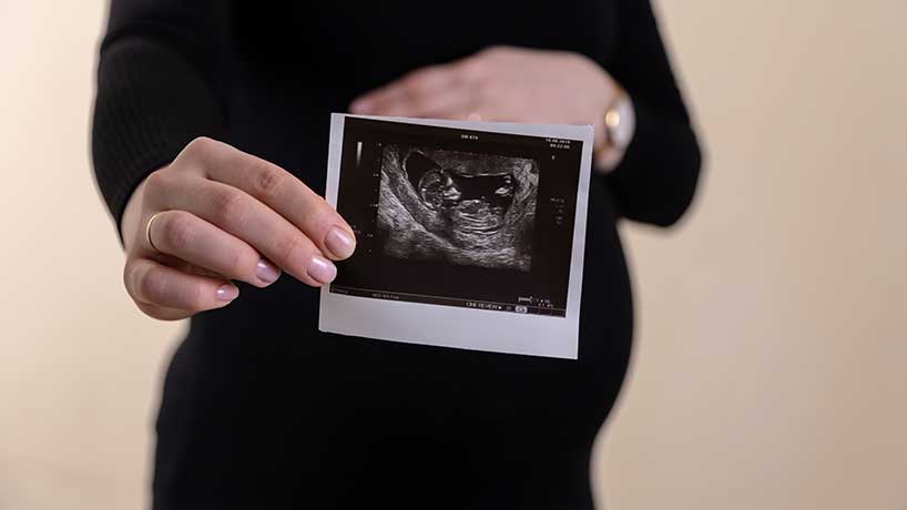 A pregnant lady holding an ultrasound scan